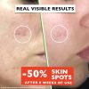 Big 2 Fl Oz. Vitamin C Face Serum. Anti Aging Dark Spot Remover Facial Serum. All-in-One Brightening Vitamin C, Niacinamide, Hyaluronic Acid & Vit E Skin Care Serum for Eye Area, Fine Lines & Wrinkles - Image 4