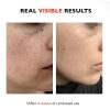 Big 2 Fl Oz. Vitamin C Face Serum. Anti Aging Dark Spot Remover Facial Serum. All-in-One Brightening Vitamin C, Niacinamide, Hyaluronic Acid & Vit E Skin Care Serum for Eye Area, Fine Lines & Wrinkles - Image 7